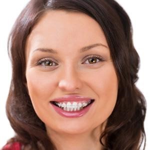 Woman with clear braces
